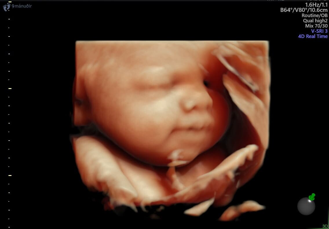 3D sónar (4D og 5D)